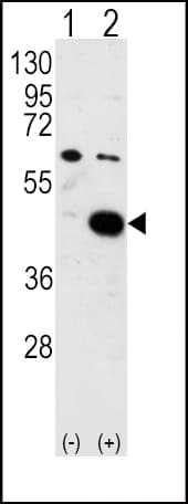 PDK2 Antibody (aa378-407)