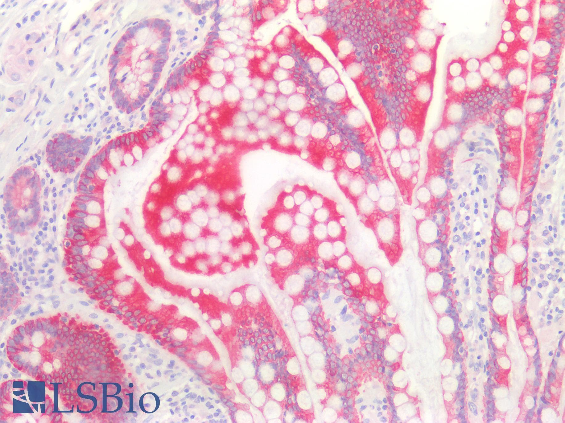 PathPlus™ KRT8 / CK8 / Cytokeratin 8 Antibody (aa2-483)