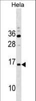 Polyclonal Rabbit anti-Human RPP14 Antibody (aa20-46, WB)