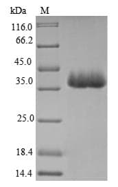 Legionella pneumophila MIP Protein (Recombinant 6His-SUMO, N-terminus)