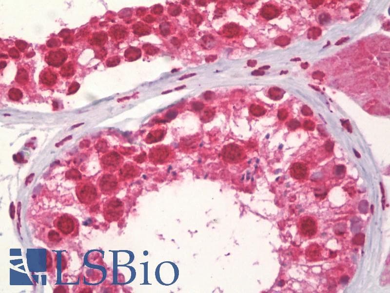 IHC-plus™ Polyclonal Rabbit anti-Human CCNA1 / Cyclin A1 Antibody (aa411-460, IHC, WB)