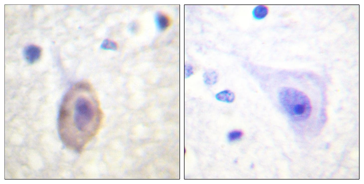 FLT1 / VEGFR1 Antibody (Ab-1333)