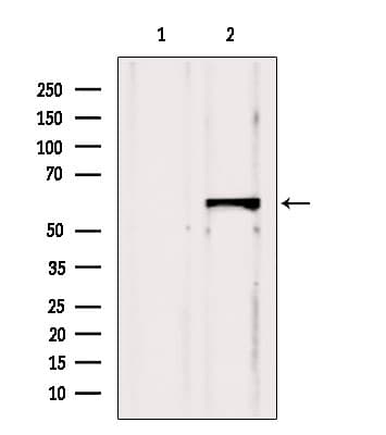 CBS Antibody