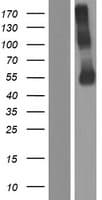 P2RX2 / P2X2 Protein (Over-Expression Lysate Myc-DDK (Flag))