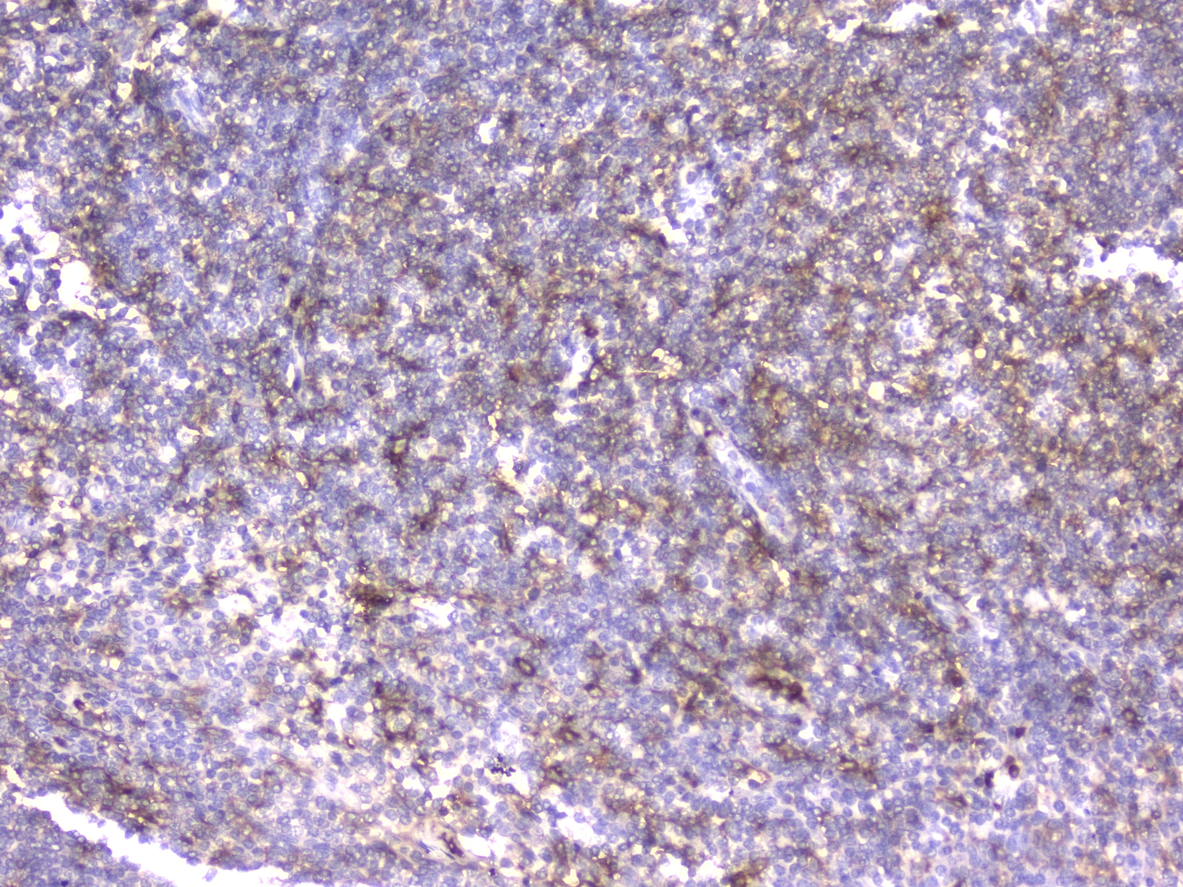 Monoclonal Mouse anti-Human ITGB2 / CD18 Antibody (IHC, WB)