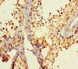 Polyclonal Rabbit anti-Human DHX35 Antibody