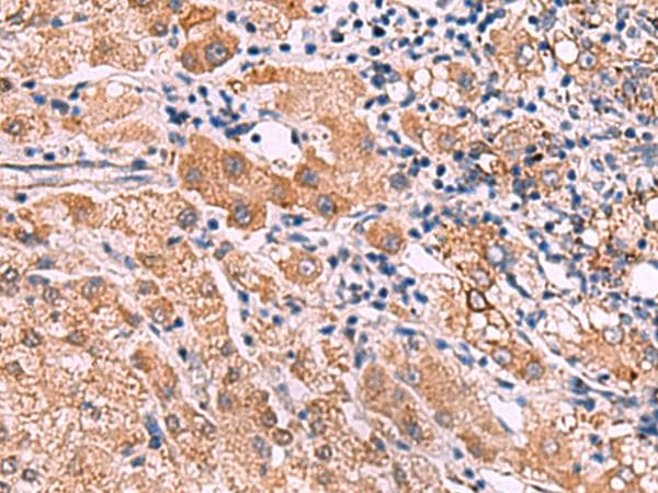 IPPK Antibody