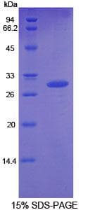 Rat GDF11 / GDF-11 Protein (Recombinant His-T7)