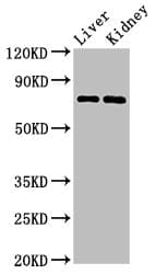 PRDM5 Antibody