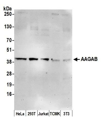 Polyclonal Rabbit anti-Human AAGAB Antibody (aa265-315, WB)