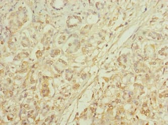 MRC2 / Endo180 Antibody