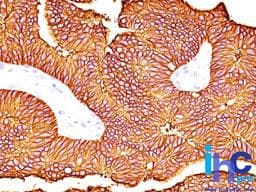 Monoclonal Mouse anti-Human EPCAM Antibody (clone 60N5D8, aa289-335, IHC, WB)