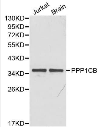 PPP1CB Antibody