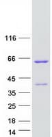 Human ANKS4B Protein (Recombinant Myc-DDK (Flag))