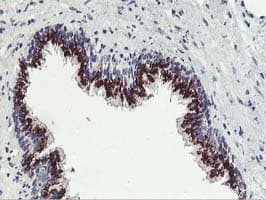 FXN / Frataxin Antibody (clone OTI1C12)