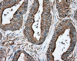 TUBA8 / Tubulin Alpha 8 Antibody (clone OTI2G6, Carrier-free)
