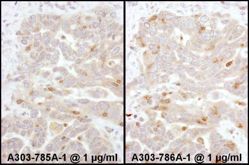 ARRB2 / Beta Arrestin 2 Antibody (aa355-405)