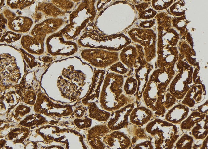 ADAMTS17 Antibody