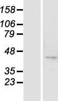 BTBD8 Protein (Over-Expression Lysate Myc-DDK (Flag))