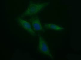 TH / Tyrosine Hydroxylase Antibody (clone OTI3G3)