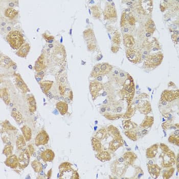HDAC4 Antibody