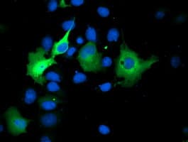 SMS / Spermine Synthase Antibody (clone OTI5C12)