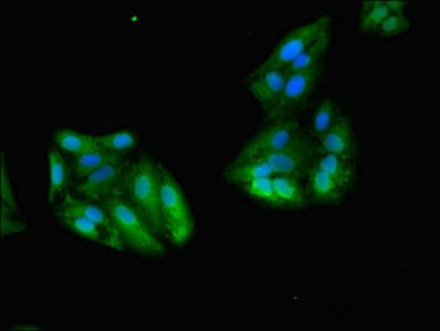 Polyclonal Rabbit anti-Human GSTA1 Antibody