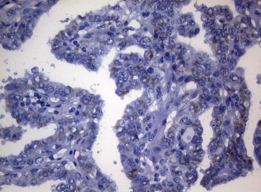 DECR1 Antibody (clone OTI10A11)