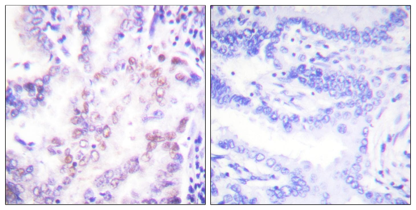 Polyclonal Rabbit anti-Human NR1A2 / THRB Antibody (IHC, WB)
