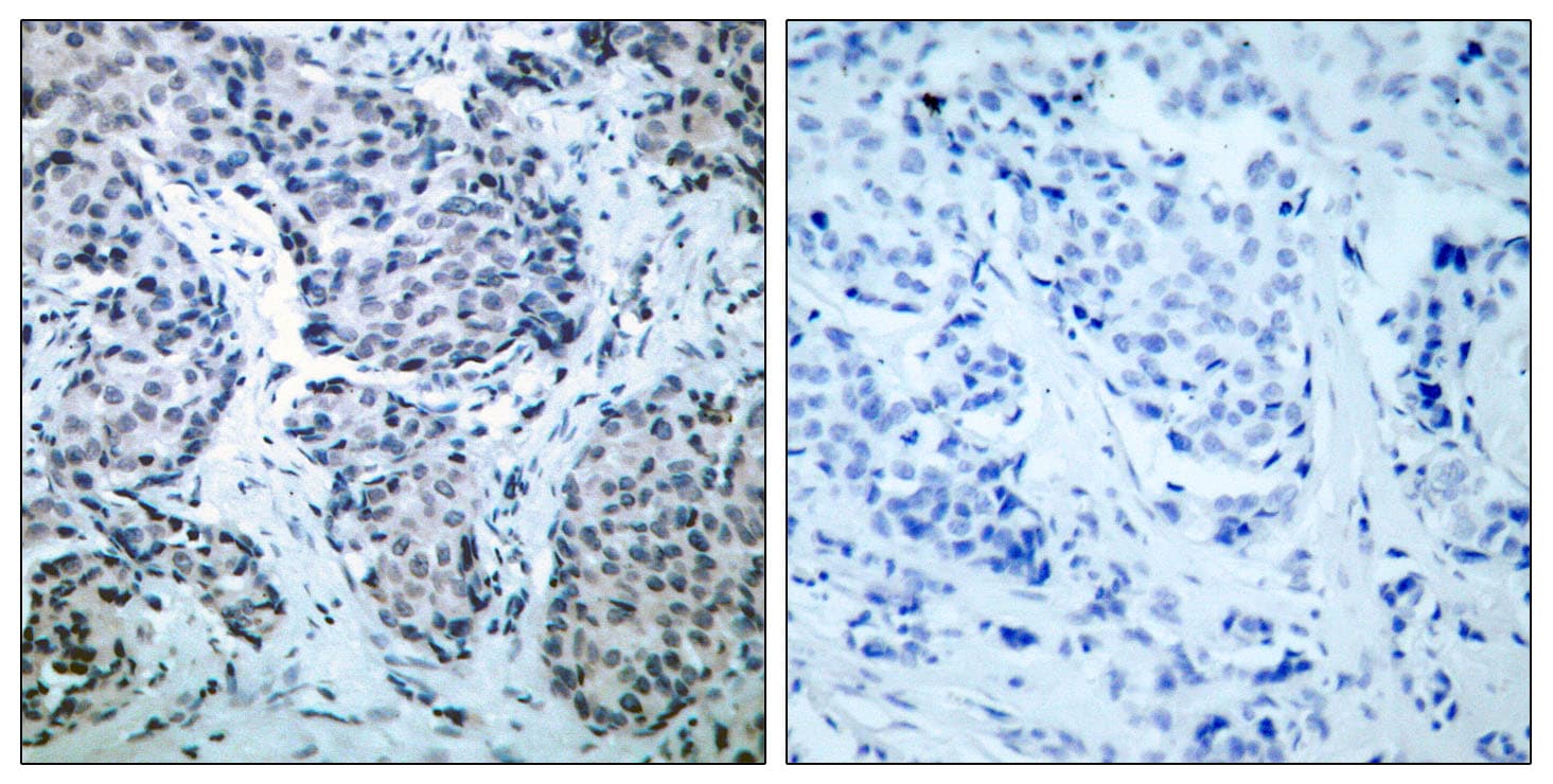 MAP2K4 / MKK4 Antibody (phospho-Thr261)