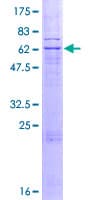 Human PARL / PSARL Protein (Recombinant GST)