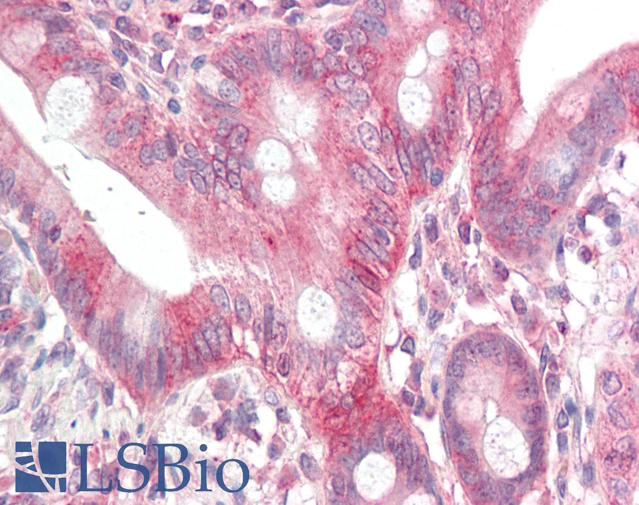 IHC-plus™ GDF1 Antibody
