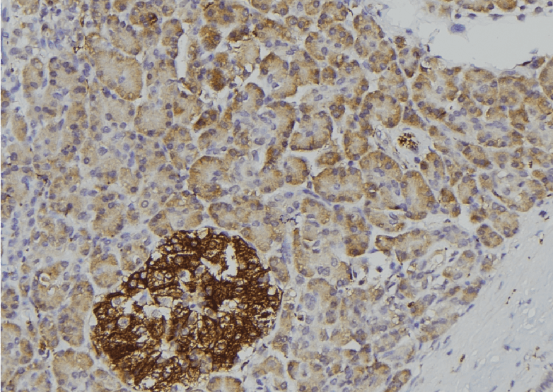 Polyclonal Rabbit anti-Human CD121b / IL1R2 Antibody (IHC, IF, WB)