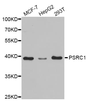 Polyclonal Rabbit anti-Human PSRC1 / DDA3 Antibody (IHC, WB)