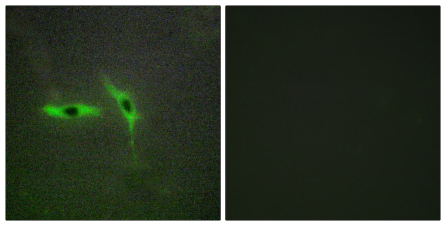 TNFRSF6B / DCR3 Antibody (aa251-300)