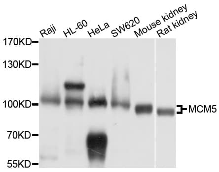 Polyclonal Rabbit anti-Human MCM5 Antibody (IHC, IF, WB)