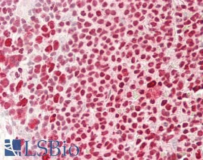 IHC-plus™ Monoclonal Mouse anti-Human IKZF1 / IKAROS Antibody (clone 1A12-F2-D8, IHC, WB)