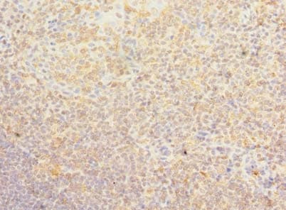 Polyclonal Rabbit anti-Human PSD4 Antibody (IHC)