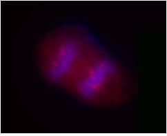 IHC-plus™ SIK2 / SNF1LK2 Antibody (clone S15G10)