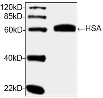 ALB / Serum Albumin Antibody (clone 2C7B4)