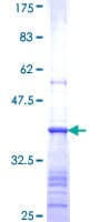 Human BAAT / BAT Protein (Recombinant GST, N-terminus)