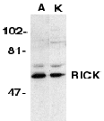 RICK / RIP2 Antibody (aa11-30)