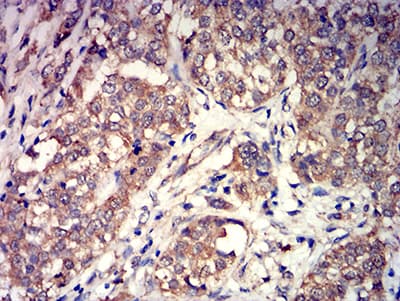GRM3 / MGLUR3 Antibody (clone 6H10C3)