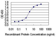 COL5A2 / Collagen V Alpha 2 Antibody (clone 3G11)
