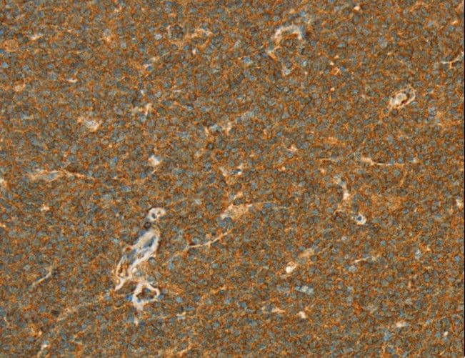IHC-plus™ APOL2 / Apolipoprotein L 2 Antibody