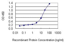 Monoclonal Mouse anti-Human CLTA / LCA Antibody (clone 4E9, WB)