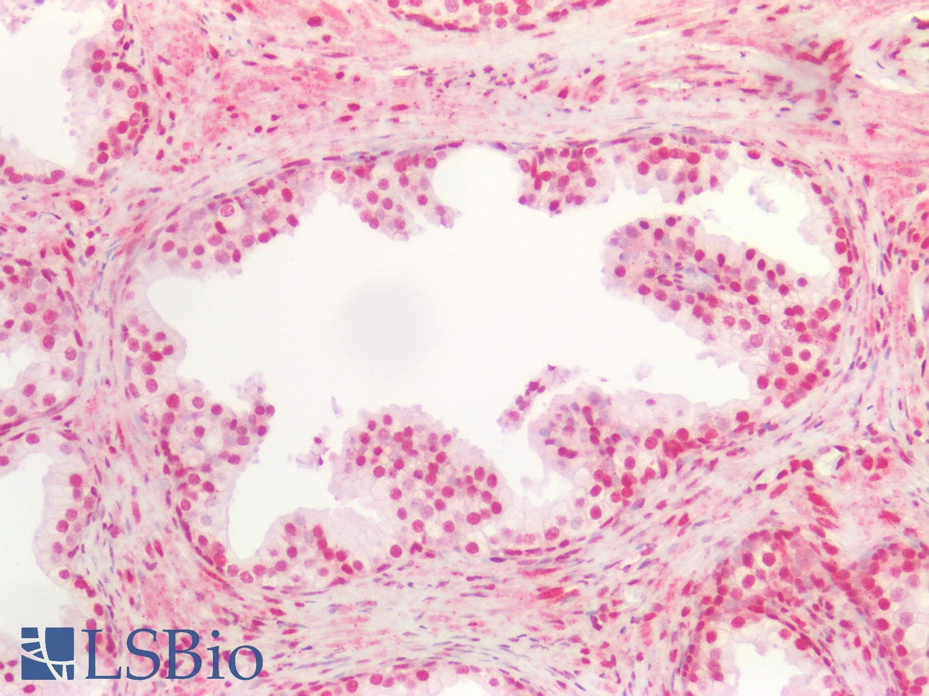 PathPlus™ Polyclonal Rabbit anti-Human HNRNPK / hnRNP K Antibody (aa380-430, IHC)