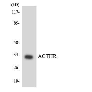MC2R / ACTHR / ACTH Receptor Antibody (aa240-289)