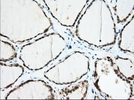 IGF2BP2 Antibody (clone OTI4C4, Carrier-free)