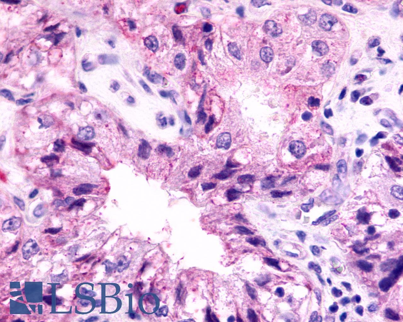 PathPlus™ ADGRV1 / GPR98 Antibody (N-Terminus)
